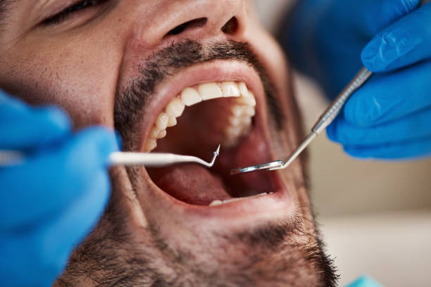 Best Full Mouth Reconstruction  in Myersville, MD